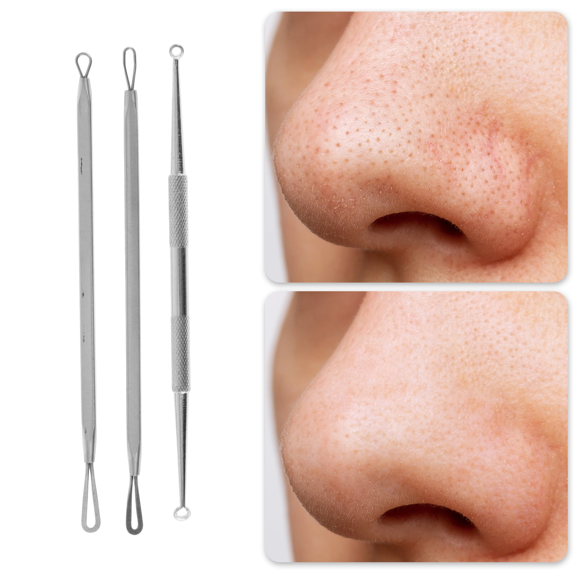 Professional Pimple Extractor  - Beauty & Makeup Katia Di Paola Palermo avis et prix