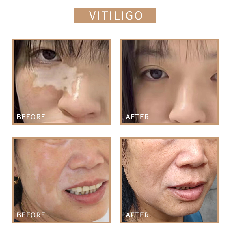 SOBER SKIN Tattoo Ink for Skin - Beauty Mark Makeup avis et prix